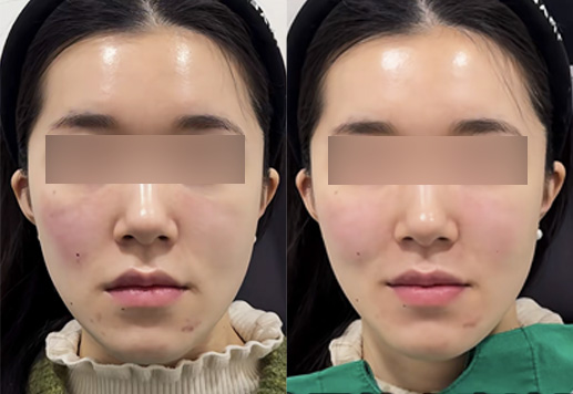 전후사진
