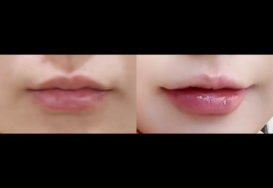전후사진