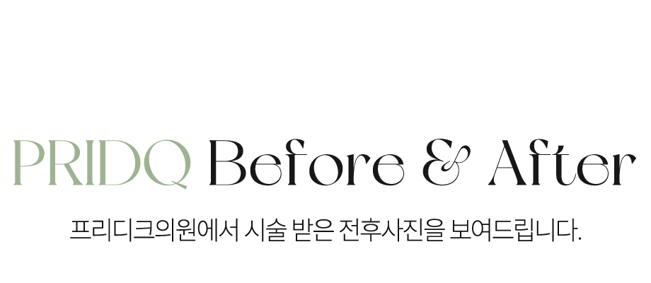프리디크 전후사진