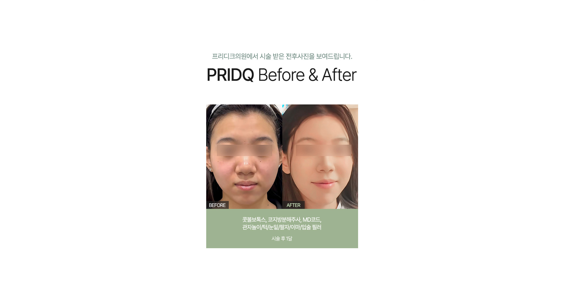 전후사진