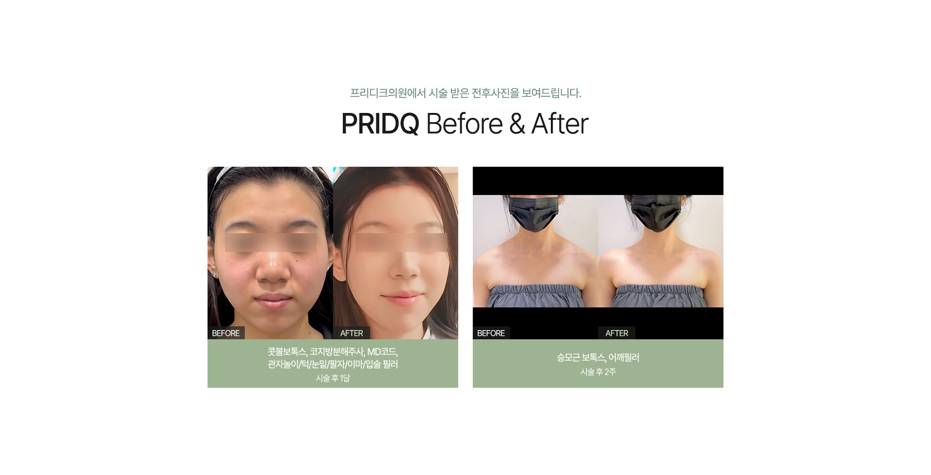 전후사진