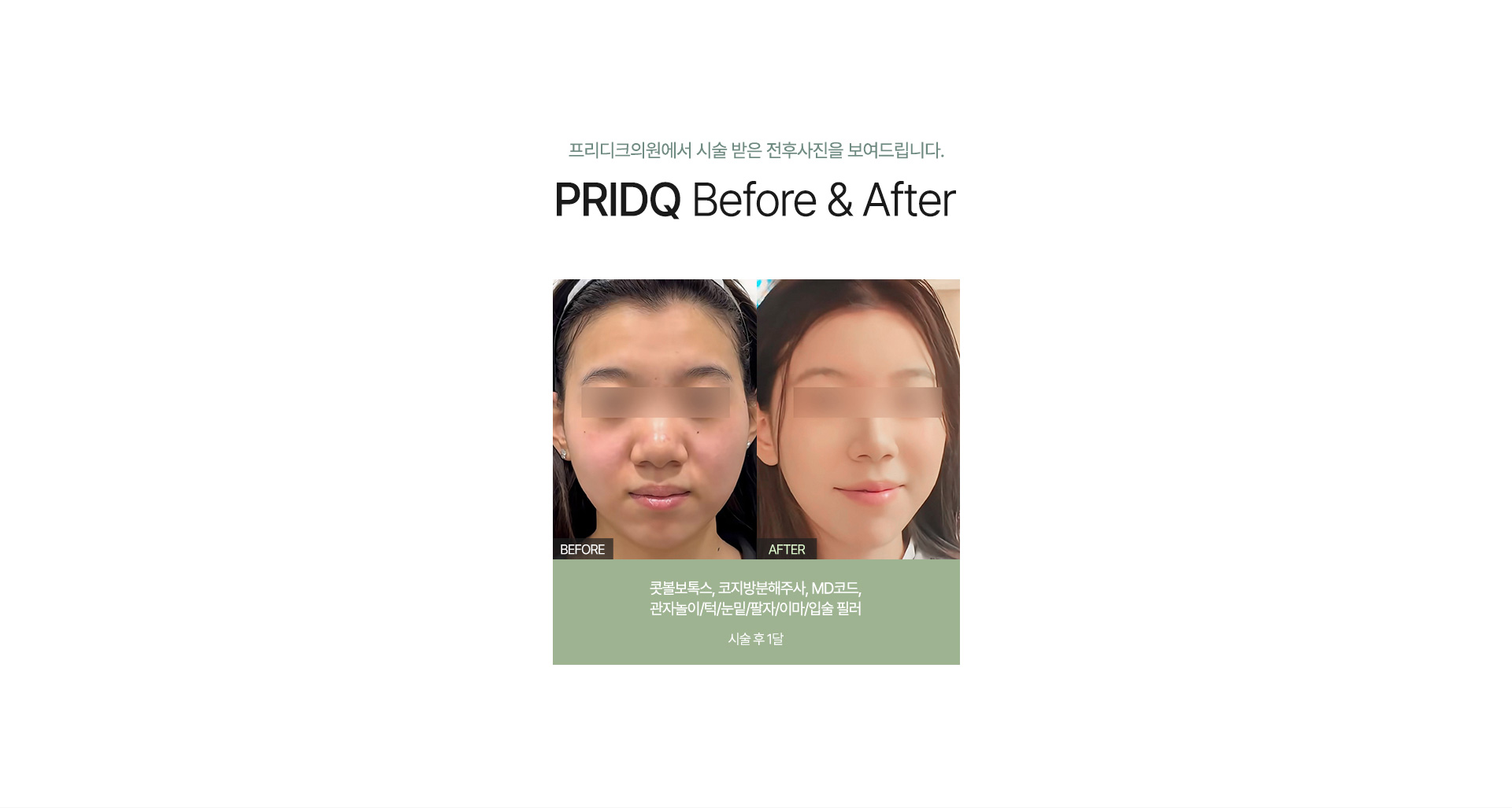 전후사진