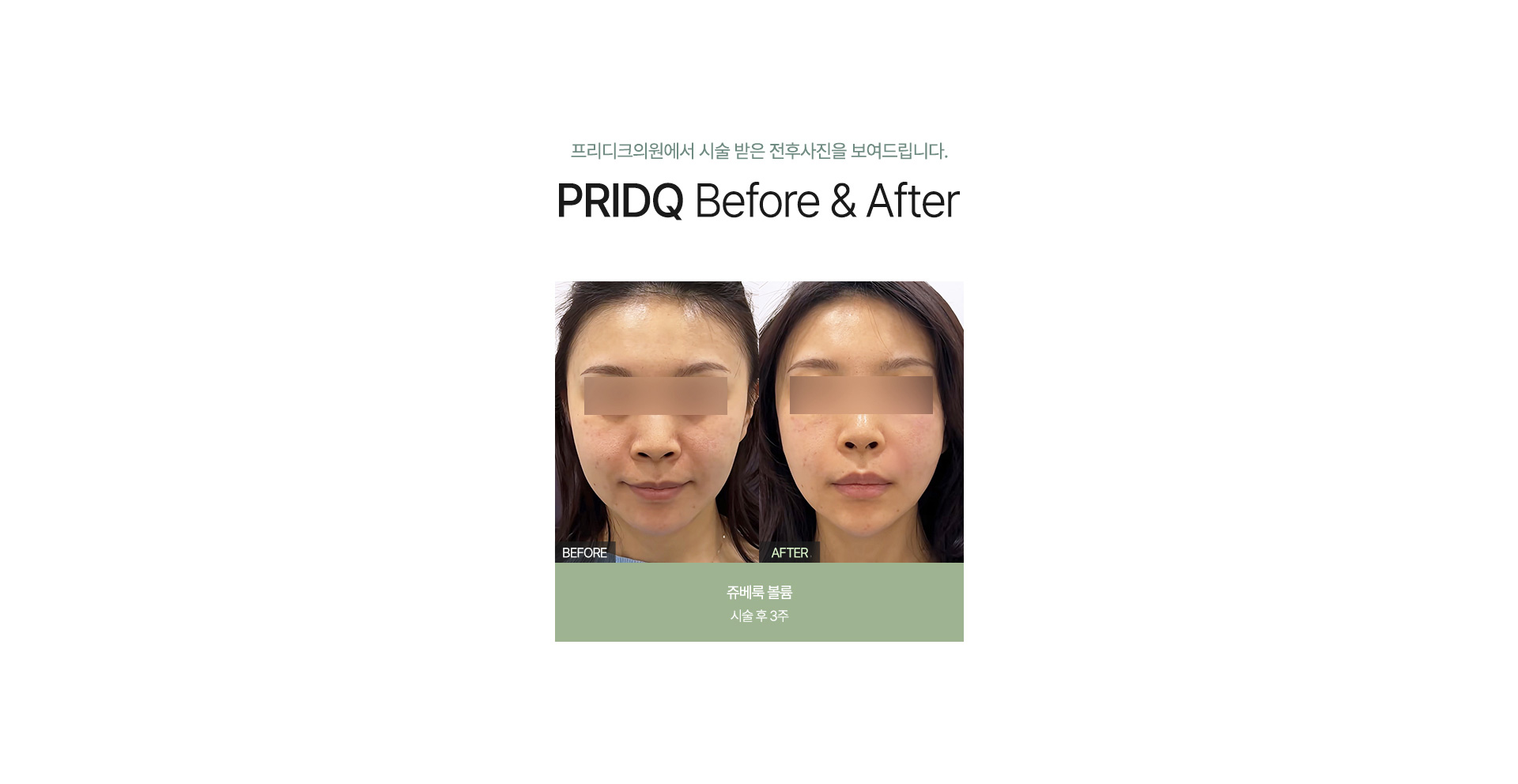 전후사진